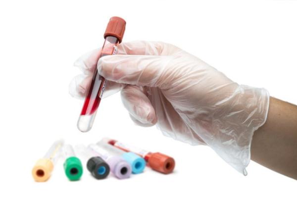 Vận chuyển bảo quản mẫu: Aldosterol, ACTH, Quantiferon...