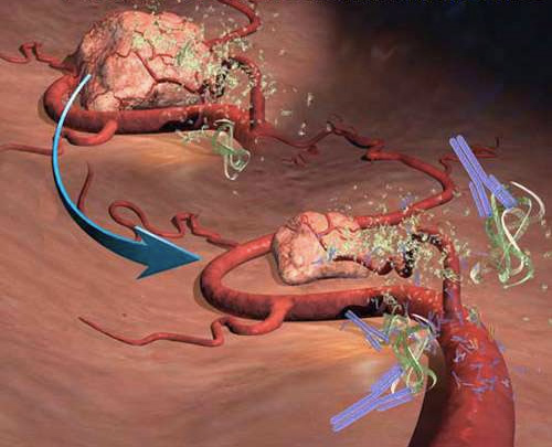 Những bước tiến đáng chú ý của liệu pháp miễn dịch điều trị ung thư